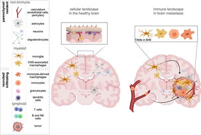 TAMs in Brain Metastasis: Molecular Signatures in Mouse and Man